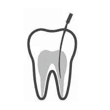 ROOT CANAL TREATMENT