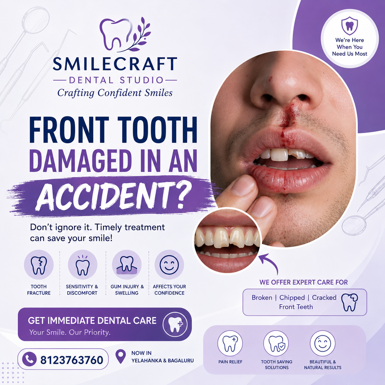 Front tooth Damage