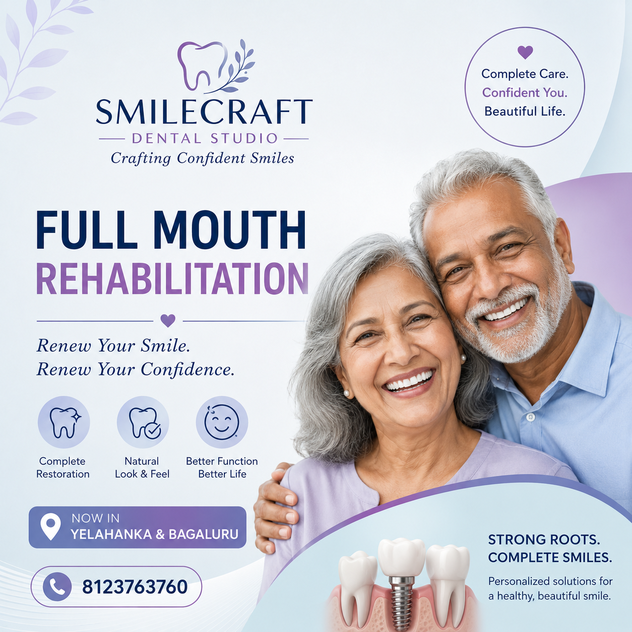 Full Mouth Rehabilitation in Yelahanka