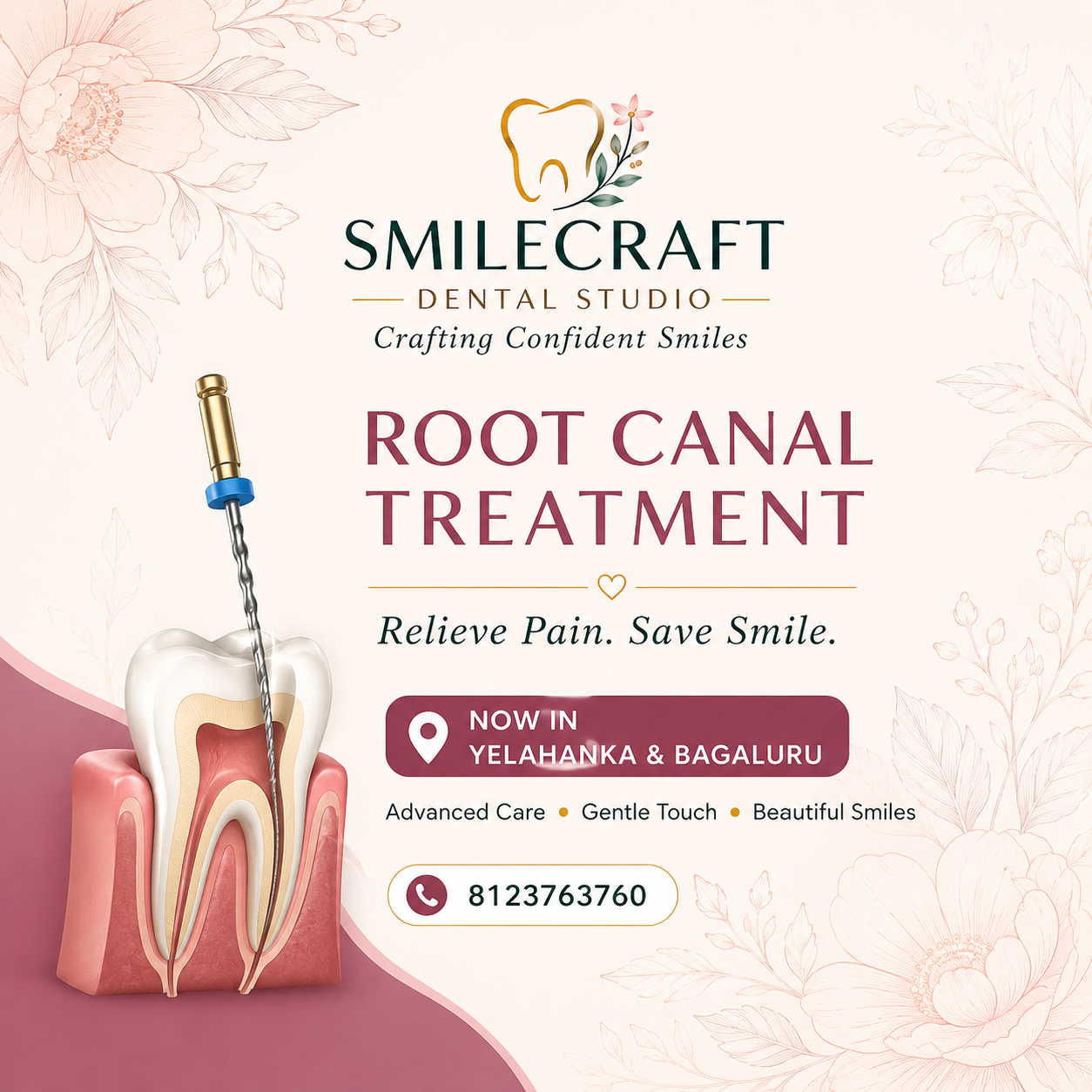 DENTIST FOR ROOT CANAL TREATMENT